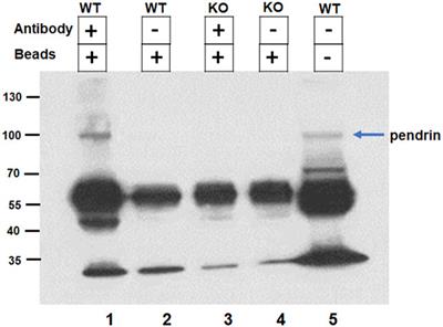 Frontiers | Identification of IQGAP1 as a SLC26A4 (Pendrin 